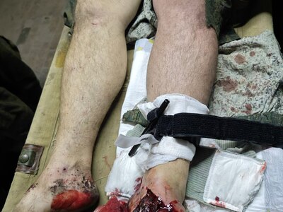 Russian Soldier Mutilated