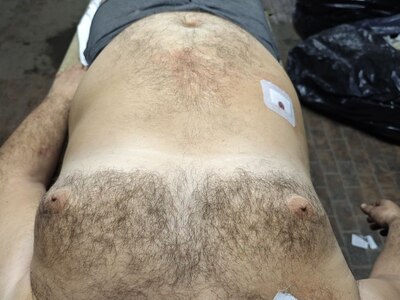 Russian Soldier Mutilated