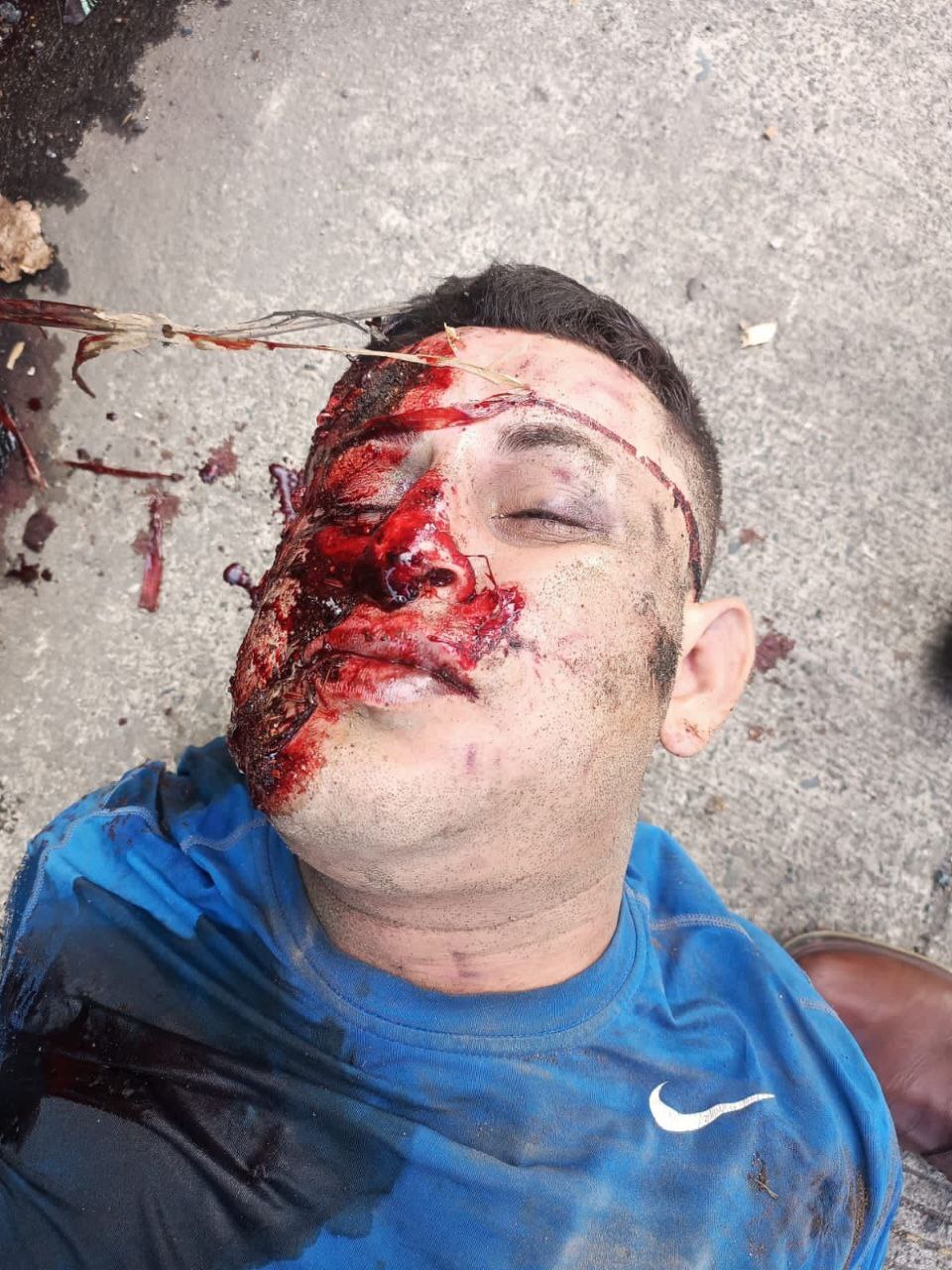 RANDOM GORE PICTURES FROM MURDER TO SUICIDE