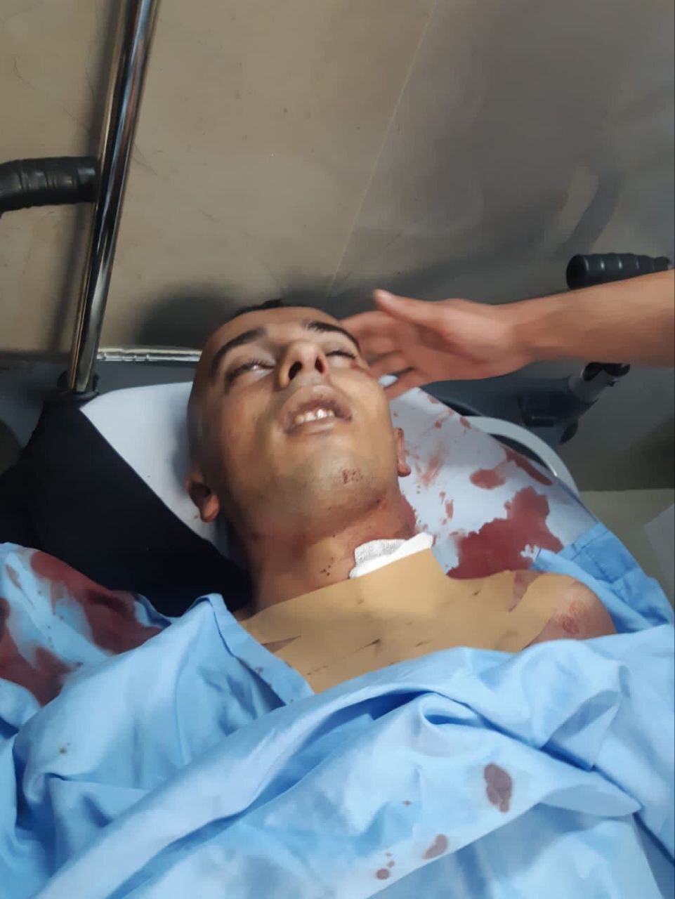 MULTIPLE DEAD PICTURES FROM THE WARZONE IN GAZA