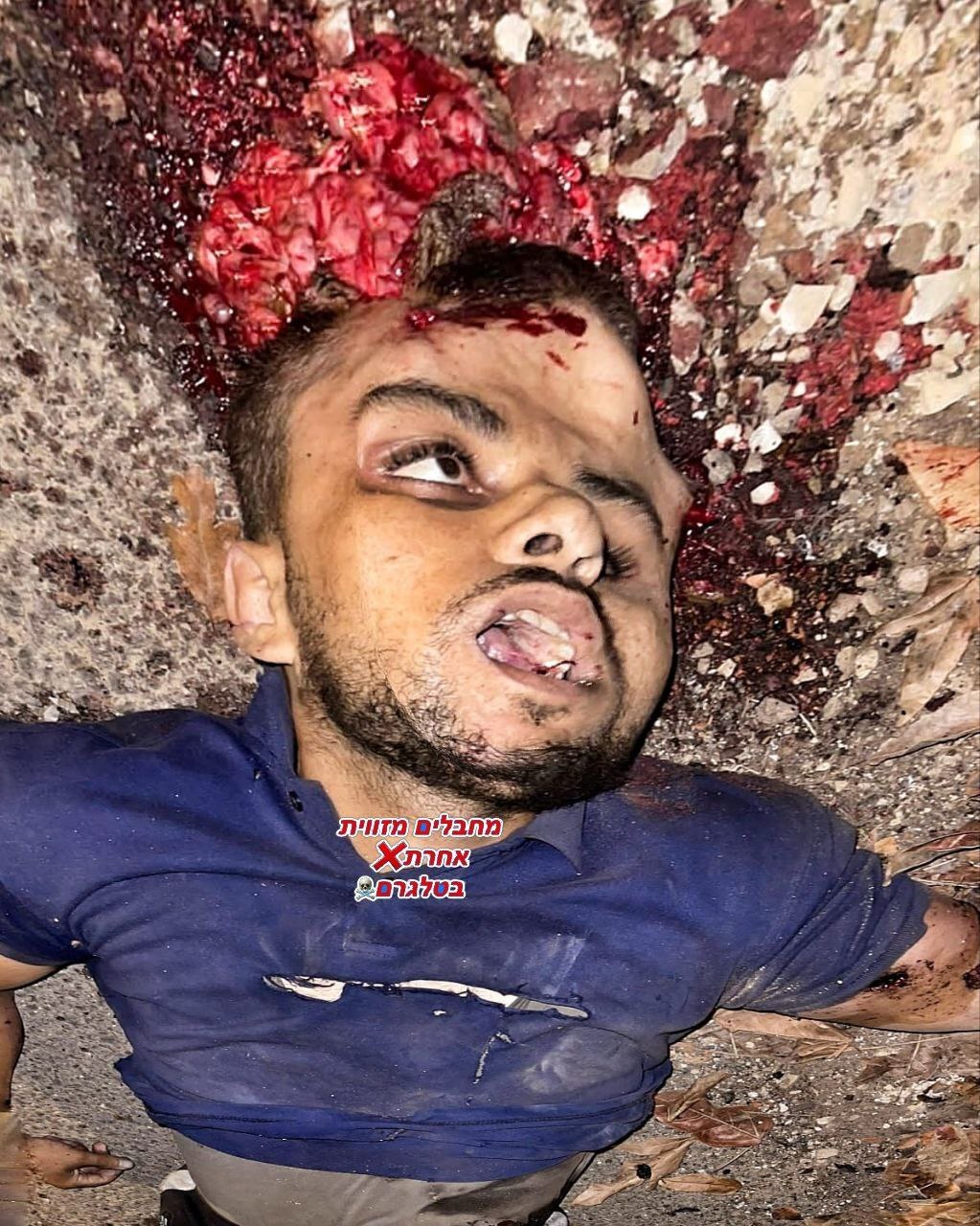 MULTIPLE DEAD PICTURES FROM THE WARZONE IN GAZA