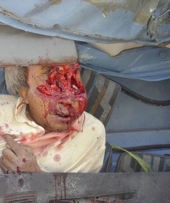 ¿¿¿¿ MEGA GORE PICTURES DROP ¿¿¿¿