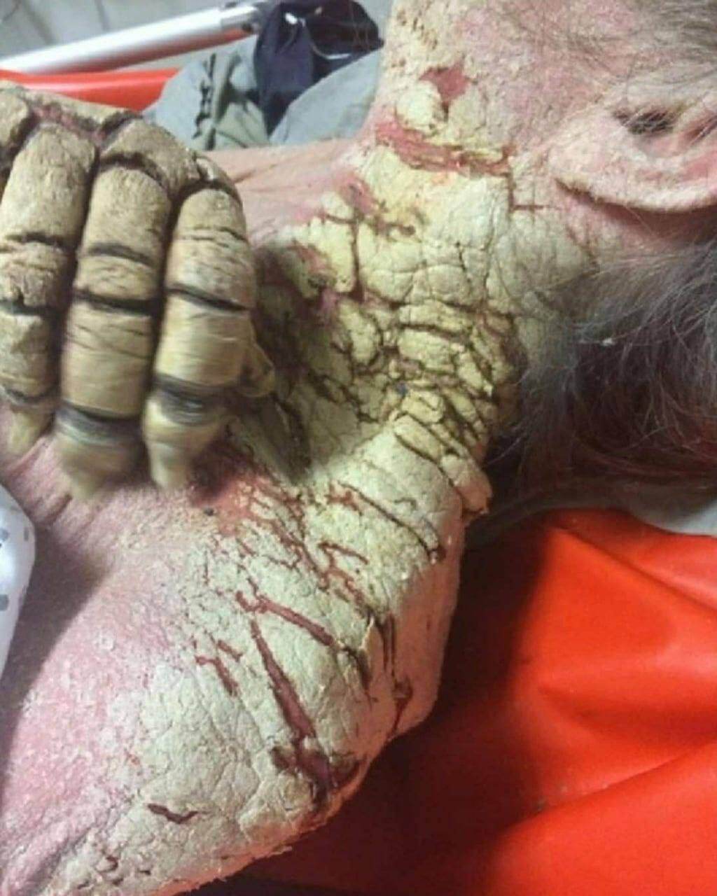 ¿¿¿¿ MEGA GORE PICTURES DROP ¿¿¿¿