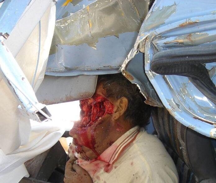 ¿¿¿¿ MEGA GORE PICTURES DROP ¿¿¿¿