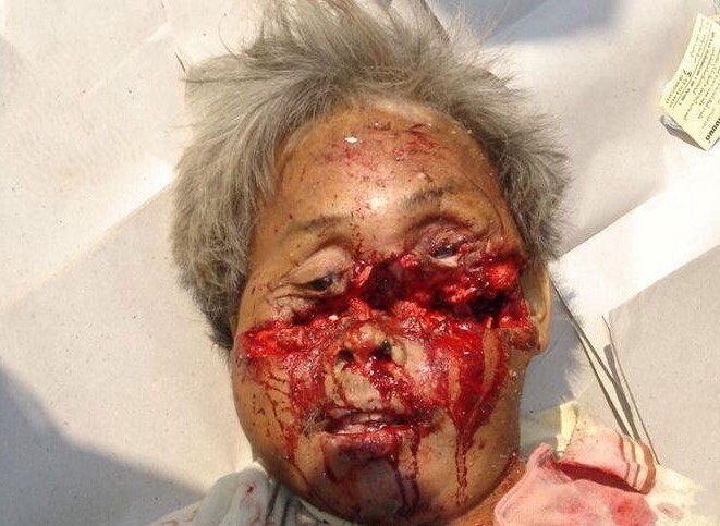 ¿¿¿¿ MEGA GORE PICTURES DROP ¿¿¿¿