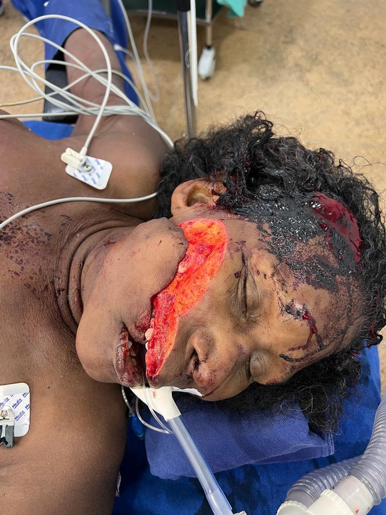 ¿¿¿¿ MEGA GORE PICTURES DROP ¿¿¿¿