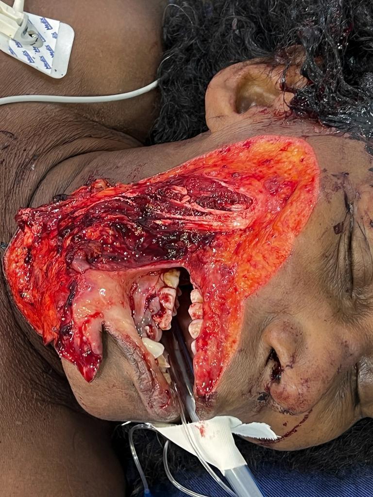 ¿¿¿¿ MEGA GORE PICTURES DROP ¿¿¿¿