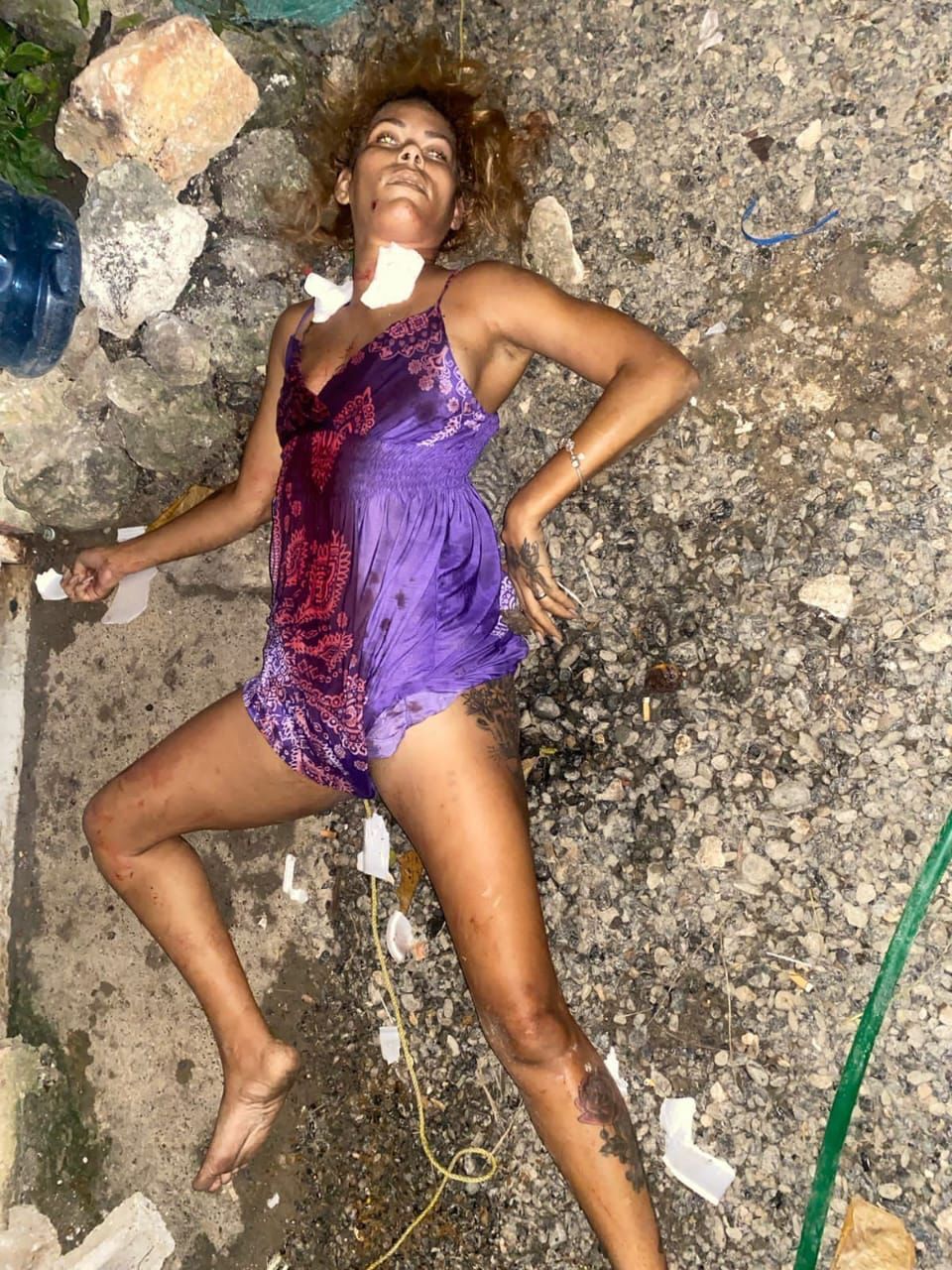 ¿¿¿¿ MEGA GORE PICTURES DROP ¿¿¿¿