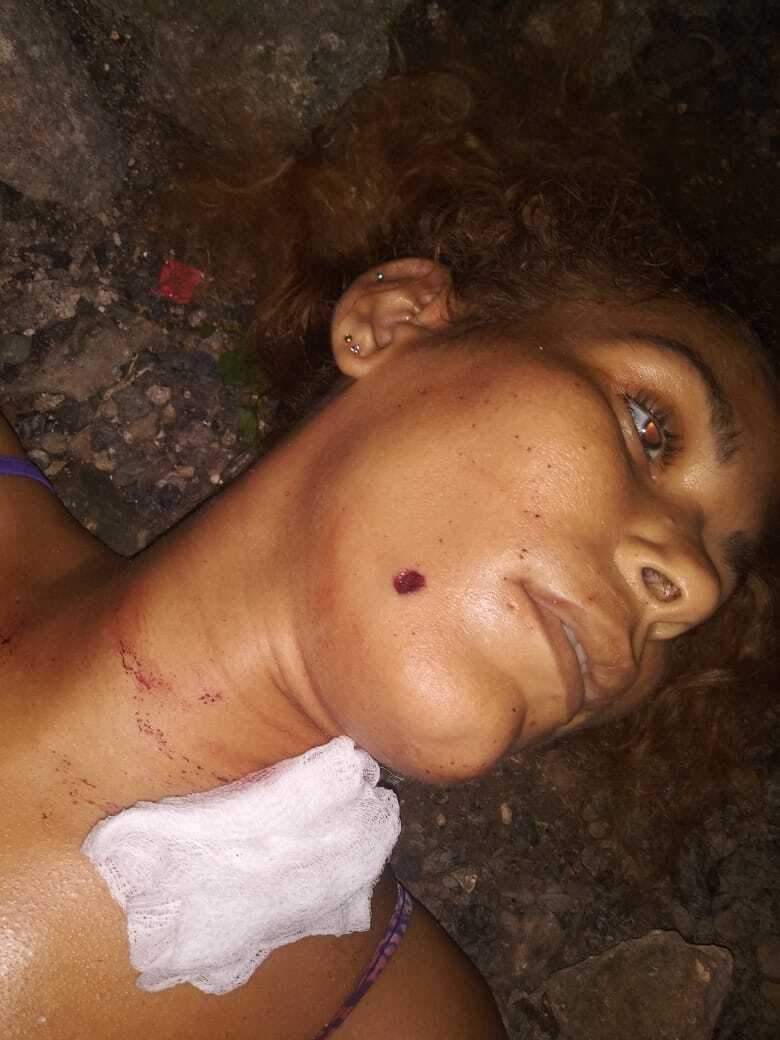 ¿¿¿¿ MEGA GORE PICTURES DROP ¿¿¿¿