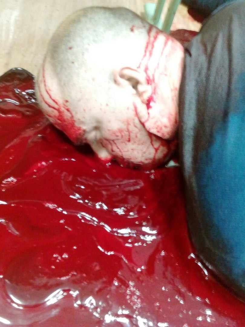 ¿¿¿¿ MEGA GORE PICTURES DROP ¿¿¿¿