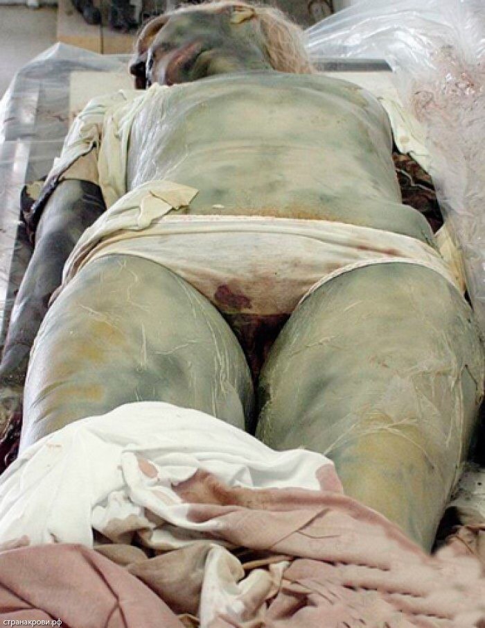 ¿¿¿¿ MEGA GORE PICTURES DROP ¿¿¿¿