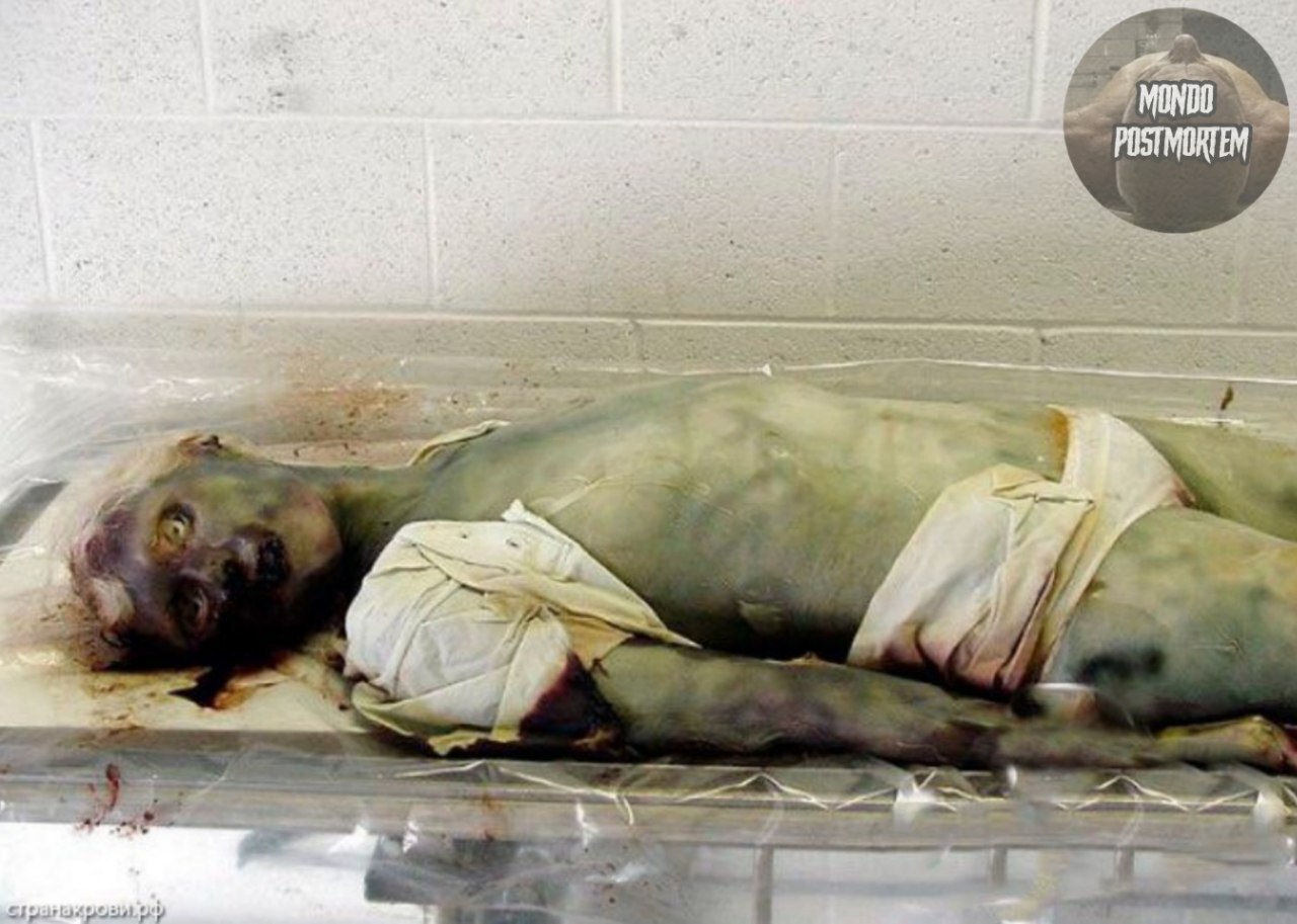 ¿¿¿¿ MEGA GORE PICTURES DROP ¿¿¿¿