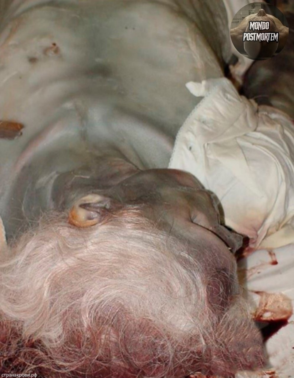 ¿¿¿¿ MEGA GORE PICTURES DROP ¿¿¿¿