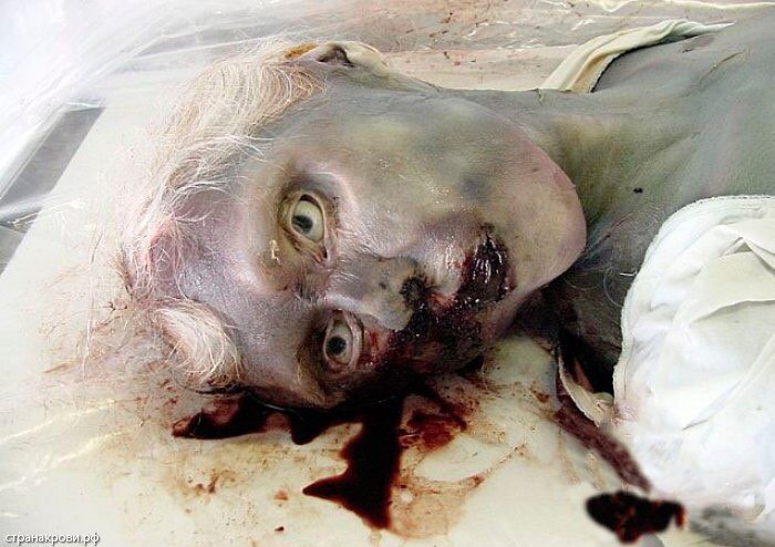 ¿¿¿¿ MEGA GORE PICTURES DROP ¿¿¿¿