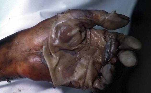 ¿¿¿¿ MEGA GORE PICTURES DROP ¿¿¿¿