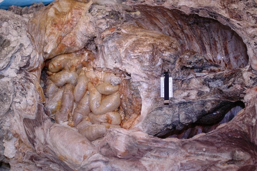 ¿¿¿¿ MEGA GORE PICTURES DROP ¿¿¿¿