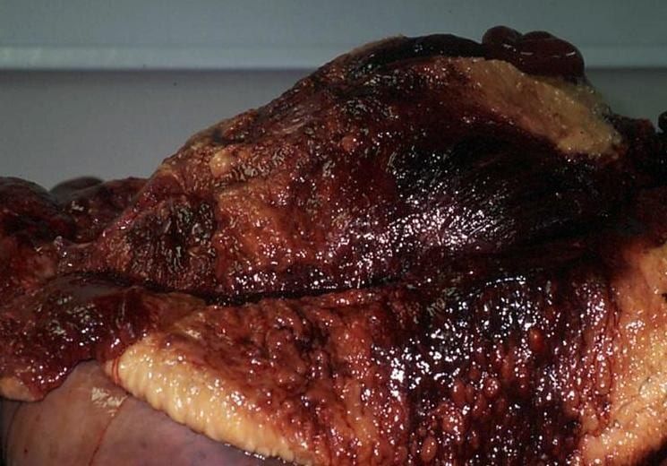 ¿¿¿¿ MEGA GORE PICTURES DROP ¿¿¿¿