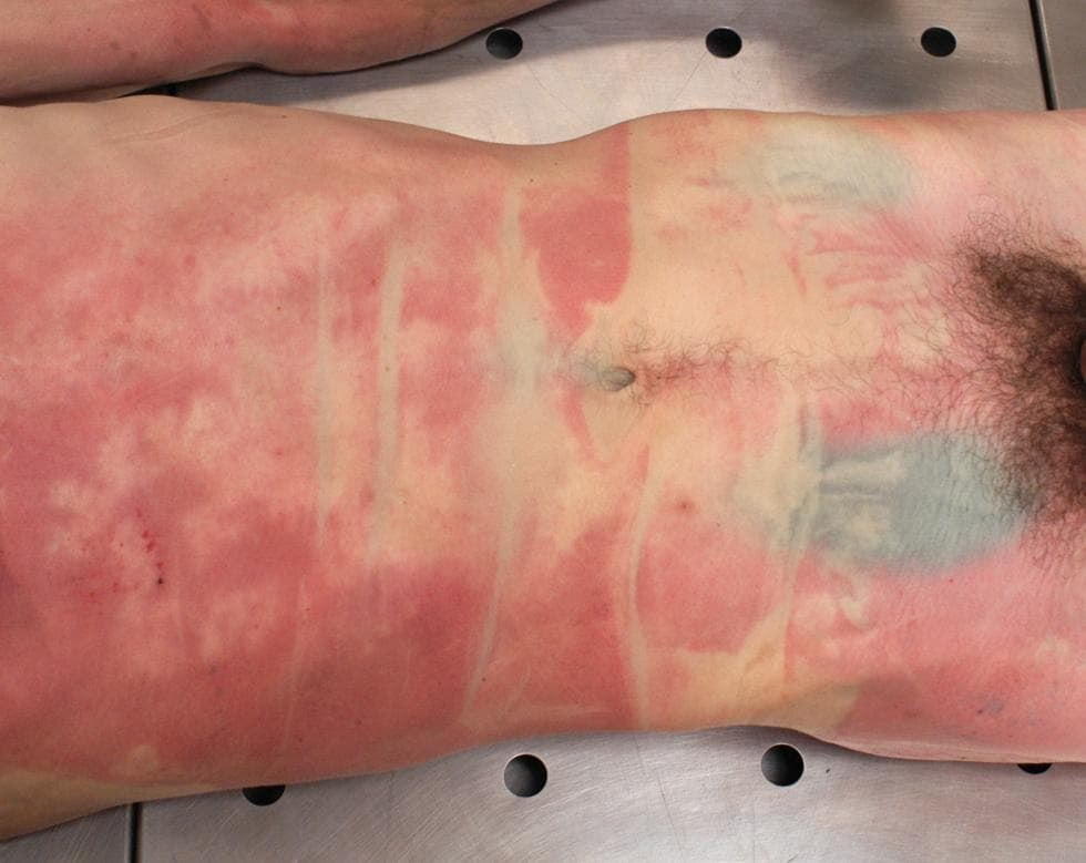 ¿¿¿¿ MEGA GORE PICTURES DROP ¿¿¿¿