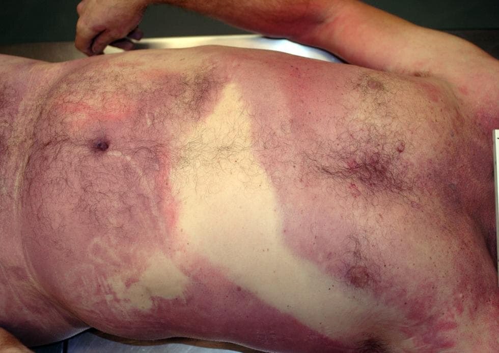 ¿¿¿¿ MEGA GORE PICTURES DROP ¿¿¿¿