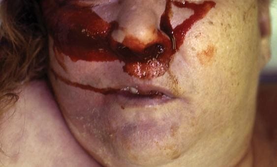 ¿¿¿¿ MEGA GORE PICTURES DROP ¿¿¿¿