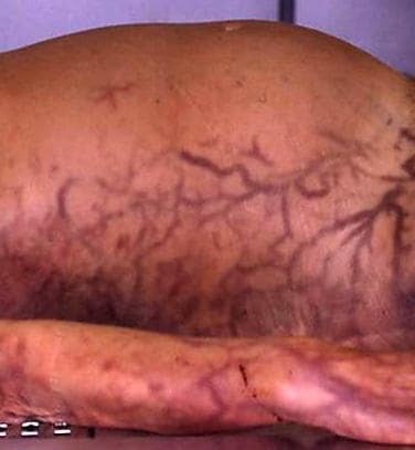 ¿¿¿¿ MEGA GORE PICTURES DROP ¿¿¿¿