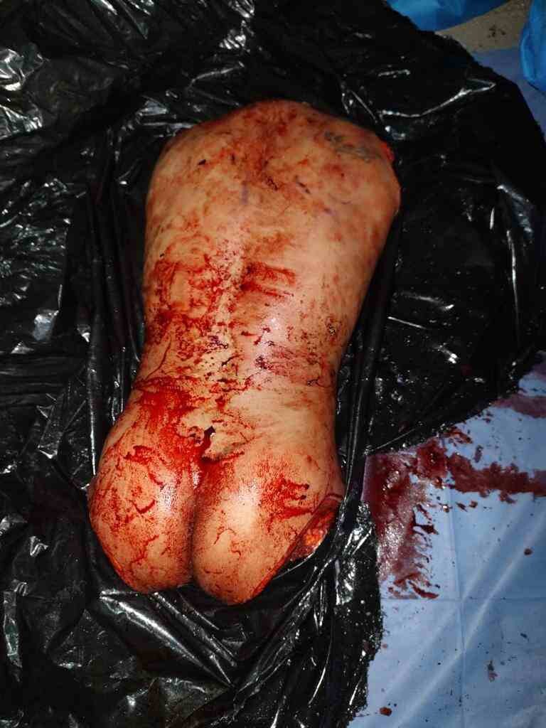 ¿¿¿¿ MEGA GORE PICTURES DROP ¿¿¿¿