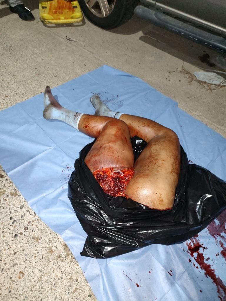 ¿¿¿¿ MEGA GORE PICTURES DROP ¿¿¿¿