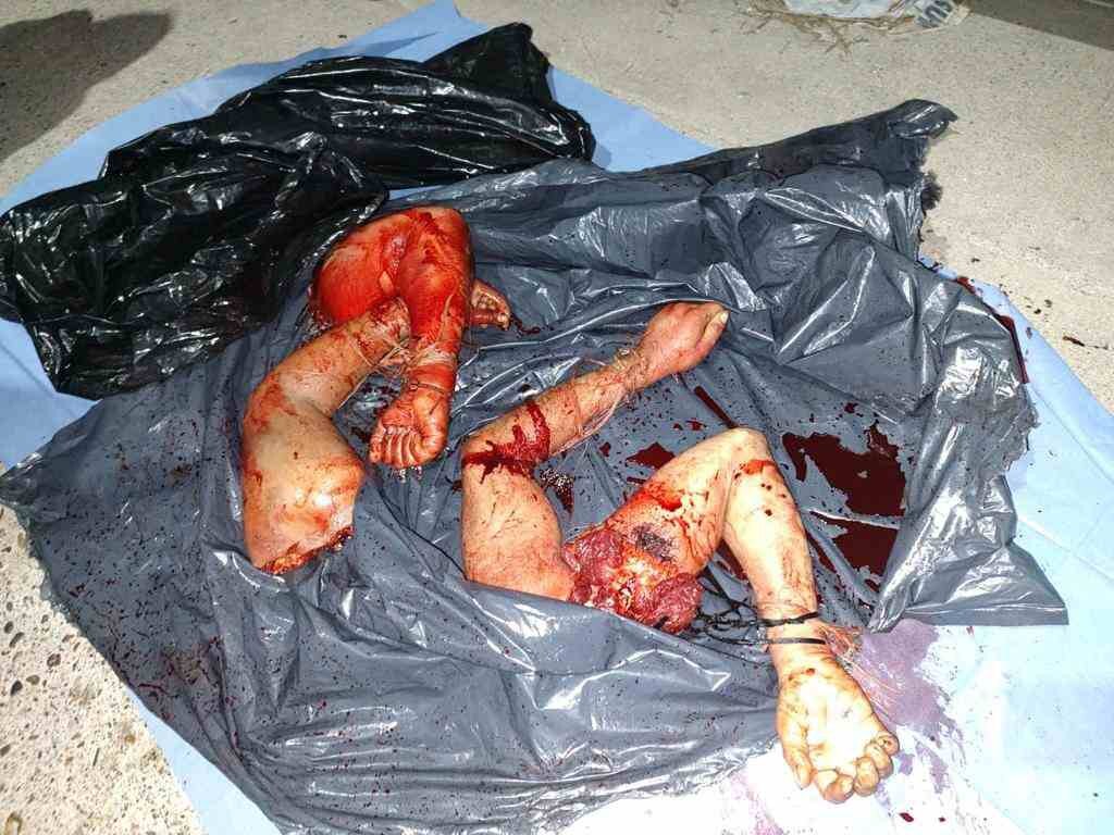 ¿¿¿¿ MEGA GORE PICTURES DROP ¿¿¿¿