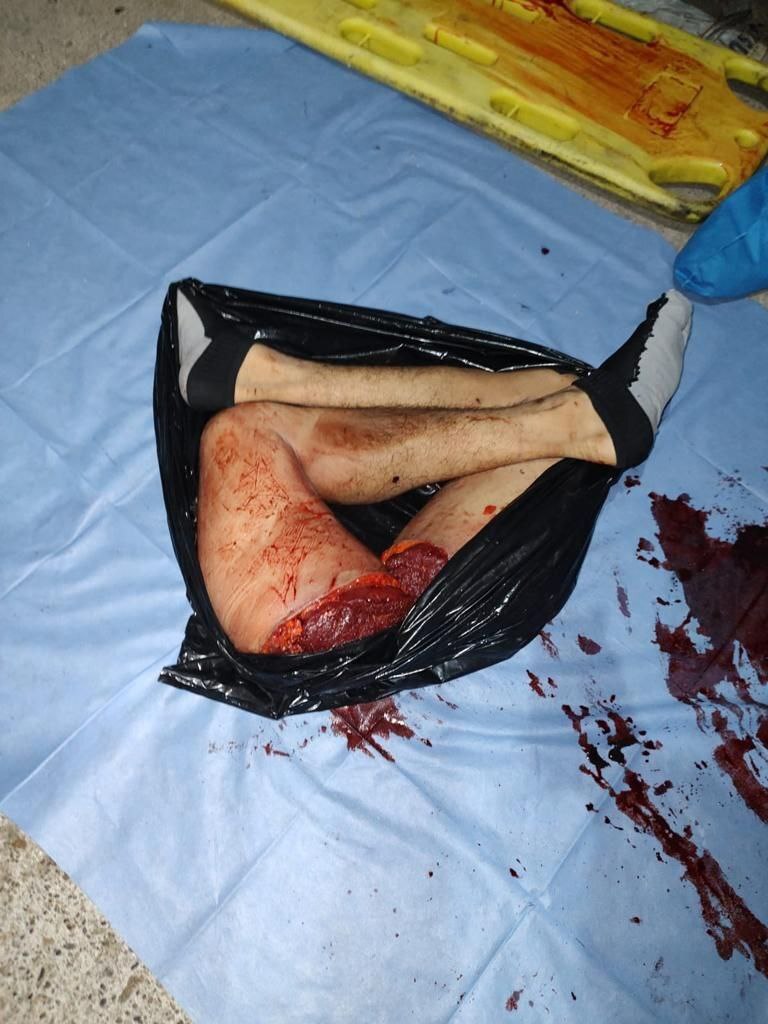 ¿¿¿¿ MEGA GORE PICTURES DROP ¿¿¿¿