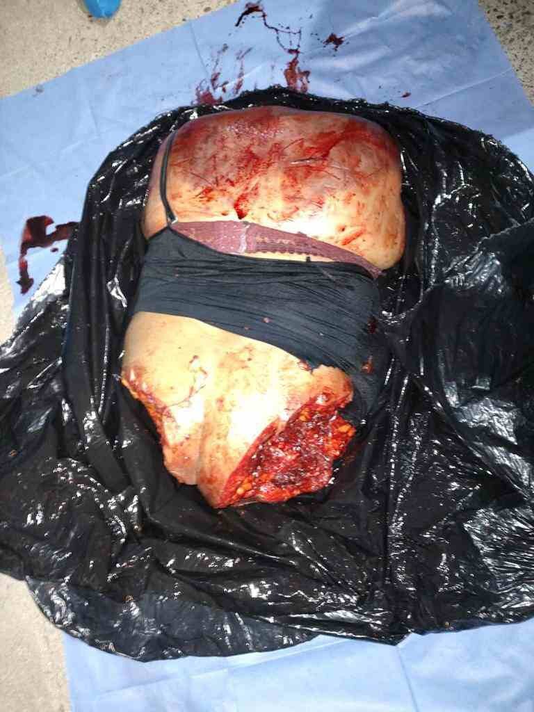 ¿¿¿¿ MEGA GORE PICTURES DROP ¿¿¿¿