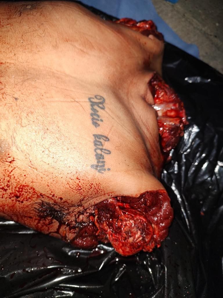 ¿¿¿¿ MEGA GORE PICTURES DROP ¿¿¿¿