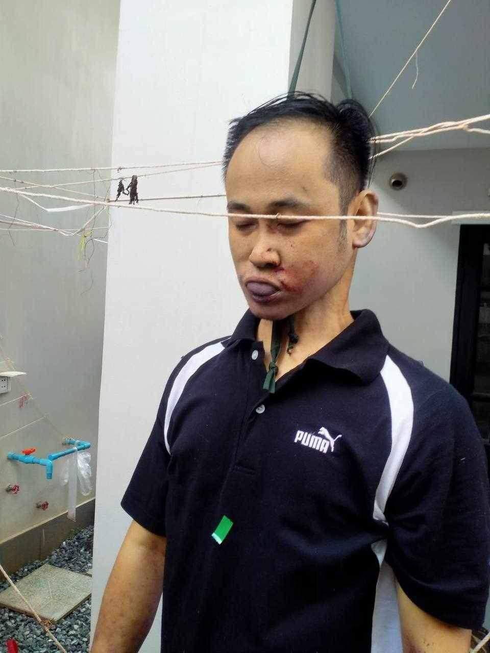 ¿¿¿¿ MEGA GORE PICTURES DROP ¿¿¿¿