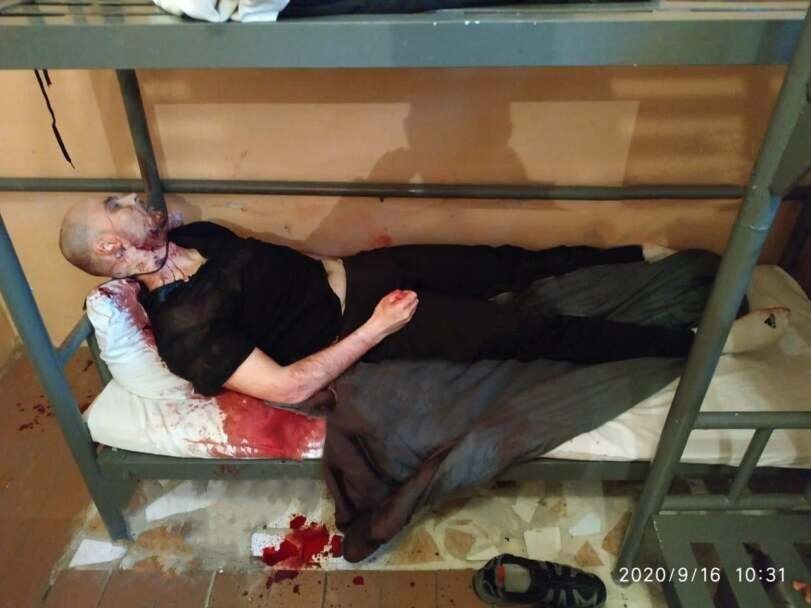 ¿¿¿¿ MEGA GORE PICTURES DROP ¿¿¿¿