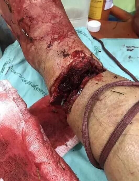 ¿¿¿¿ MEGA GORE PICTURES DROP ¿¿¿¿