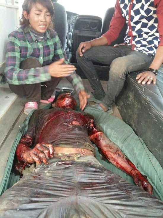 ¿¿¿¿ MEGA GORE PICTURES DROP ¿¿¿¿