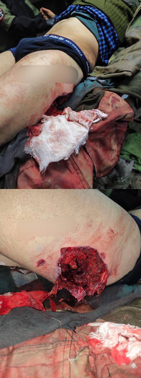 God bless America. Thanks for the cluster munition.