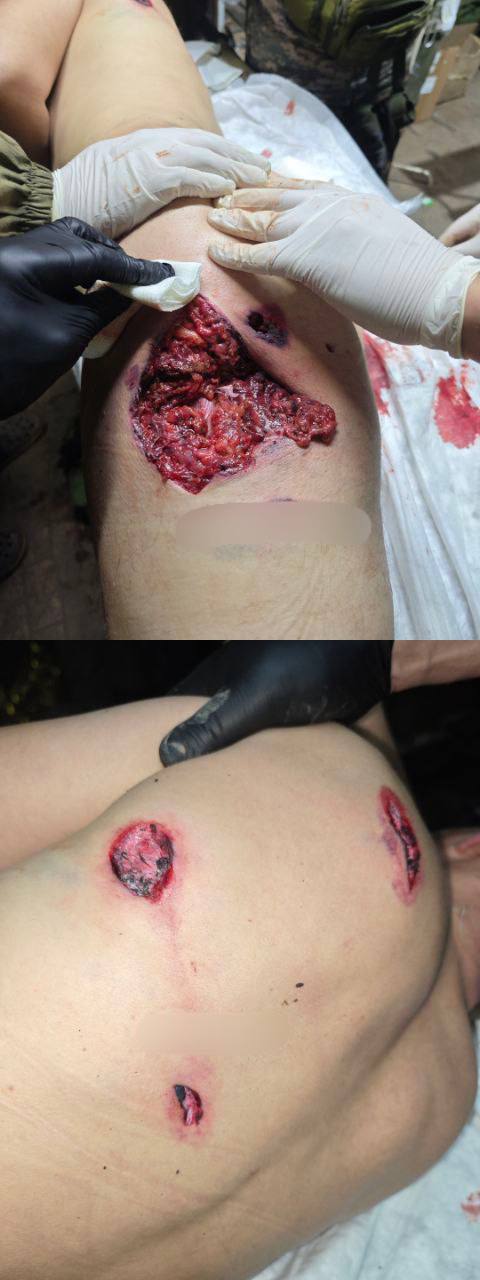 God bless America. Thanks for the cluster munition.