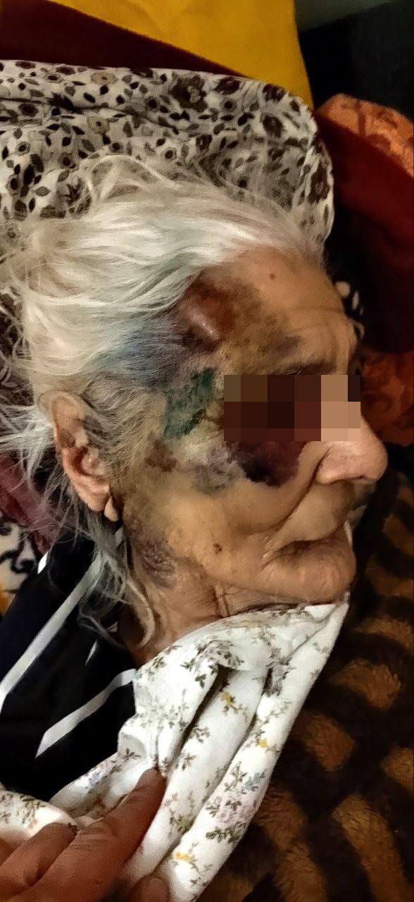 Pensioner was beaten in hospital