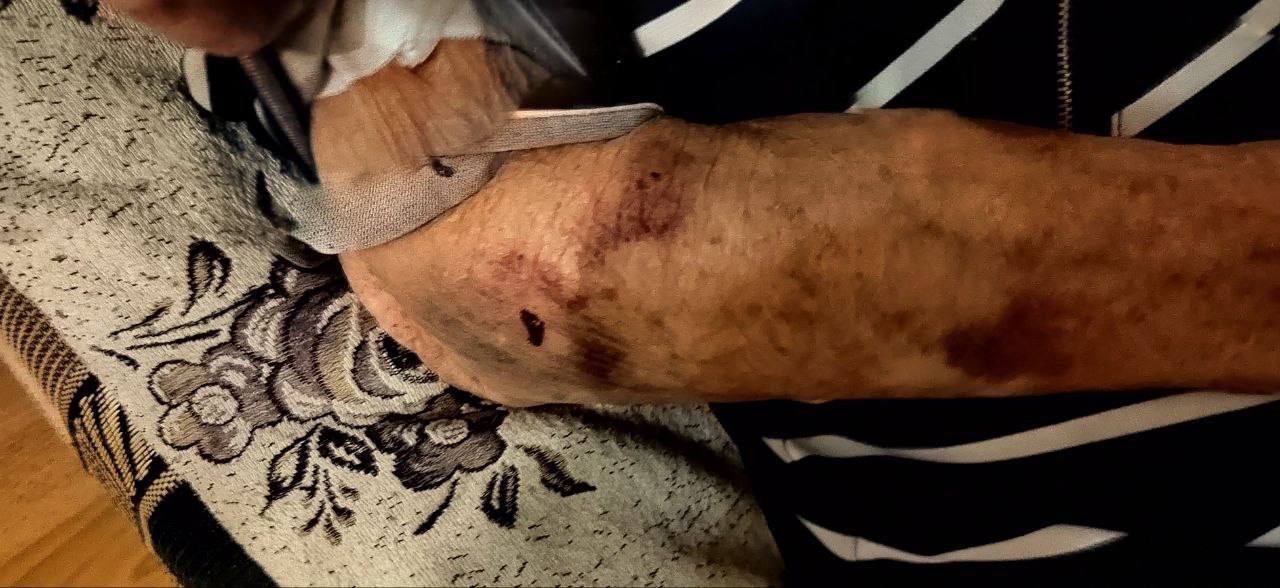 Pensioner was beaten in hospital