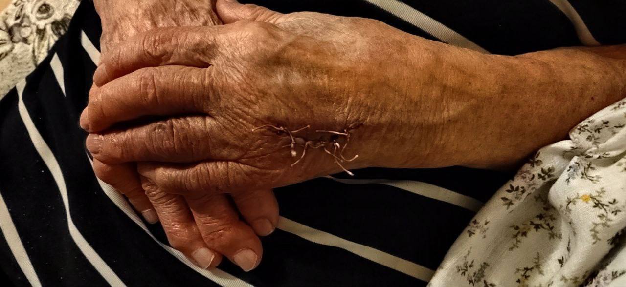 Pensioner was beaten in hospital