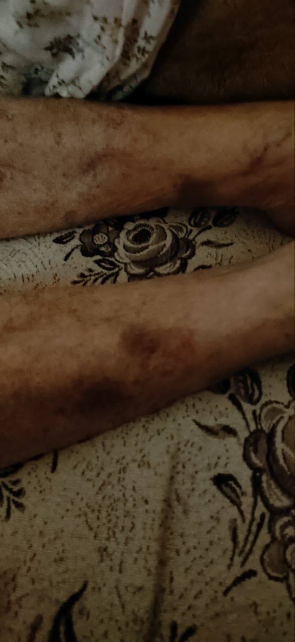 Pensioner was beaten in hospital