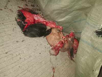 Accident in gapan Nueva Ecija Philippines