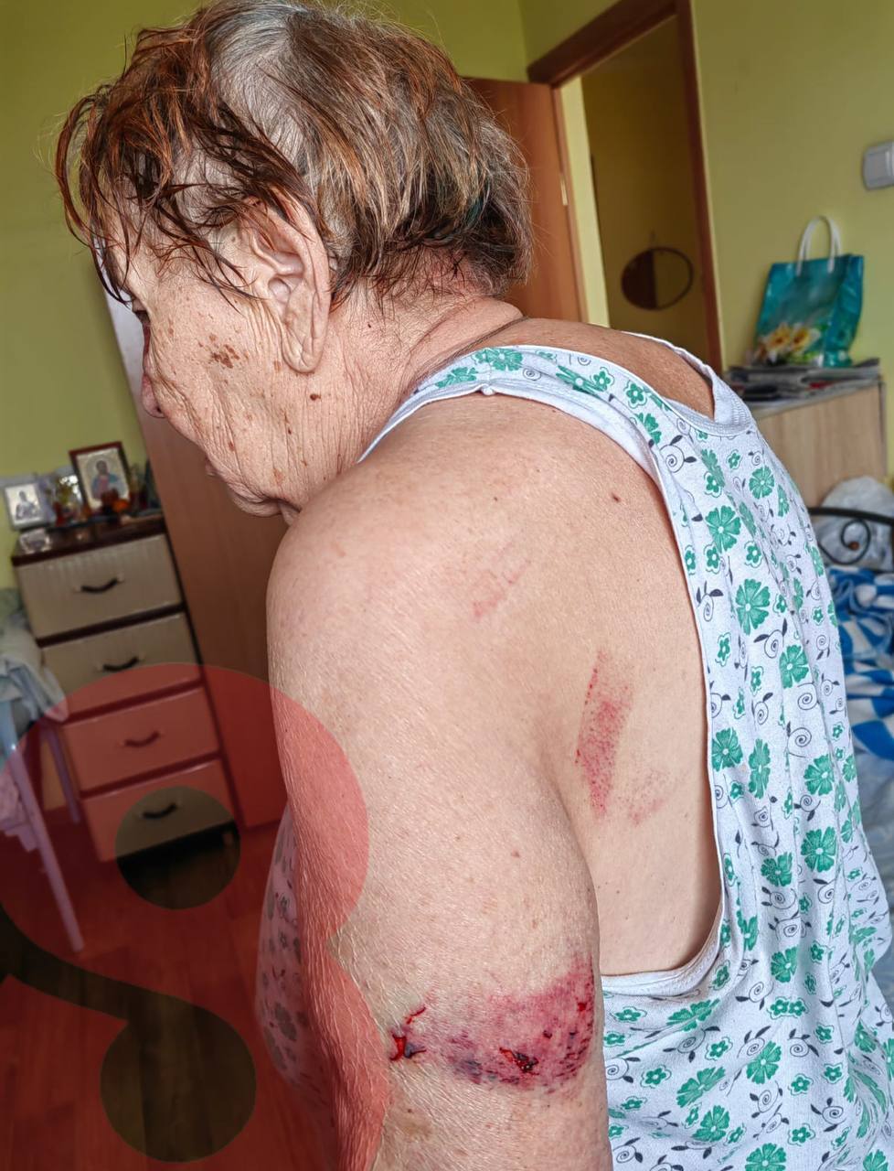 Grandma Gets Beaten By Neighbors