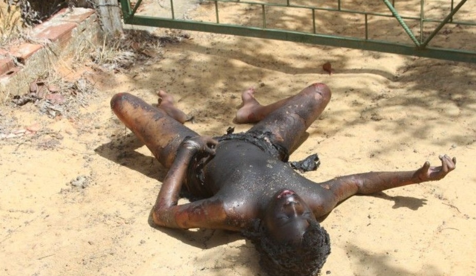 Prostitute Gets Beaten Unconscious And Burned Alive