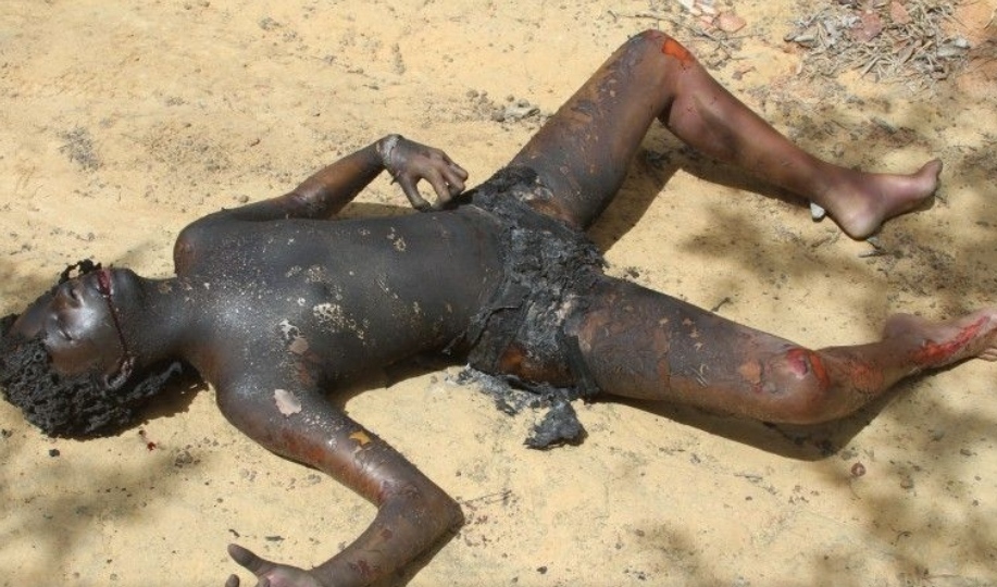 Prostitute Gets Beaten Unconscious And Burned Alive