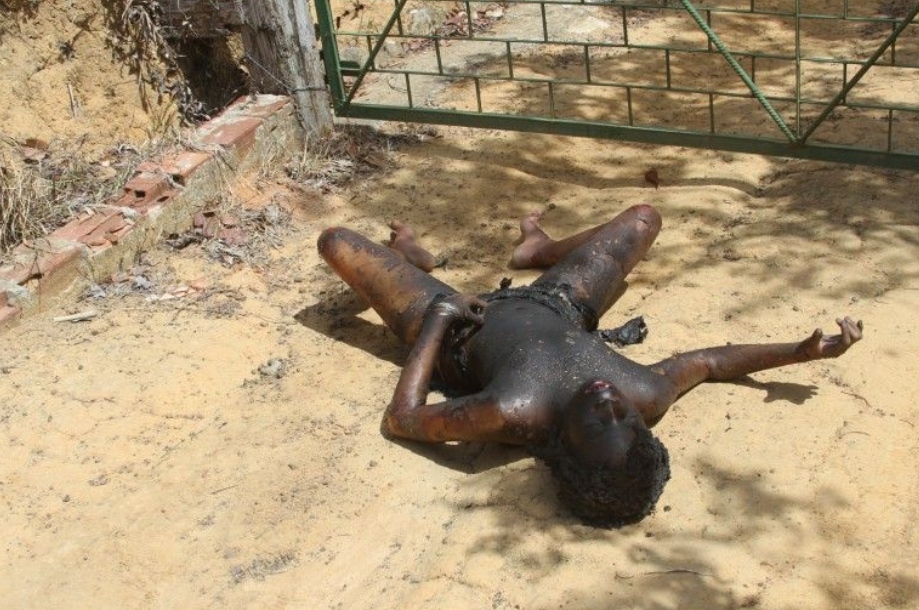 Prostitute Gets Beaten Unconscious And Burned Alive