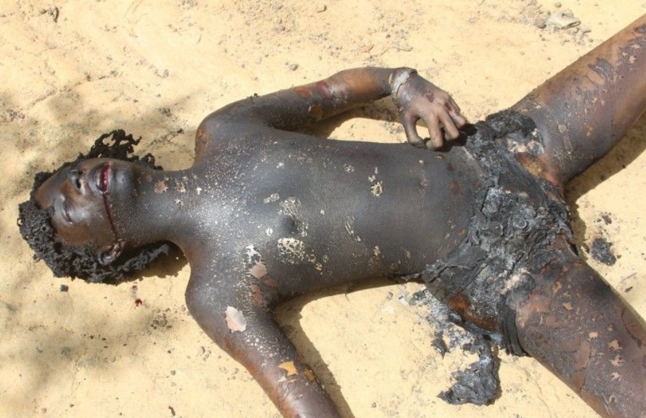 Prostitute Gets Beaten Unconscious And Burned Alive