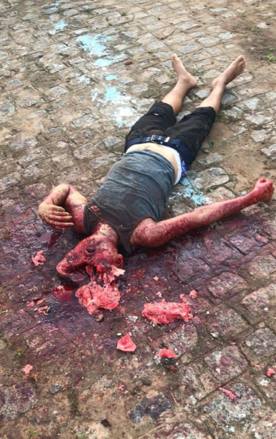 His Head Gets Crushed By Stone