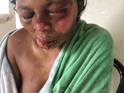 Woman Gets Found Naked And With Signs Of Sexual Assault