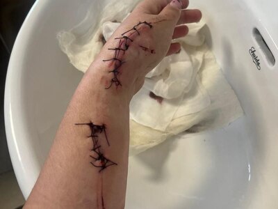 Student Beats His Girlfriend in Forest